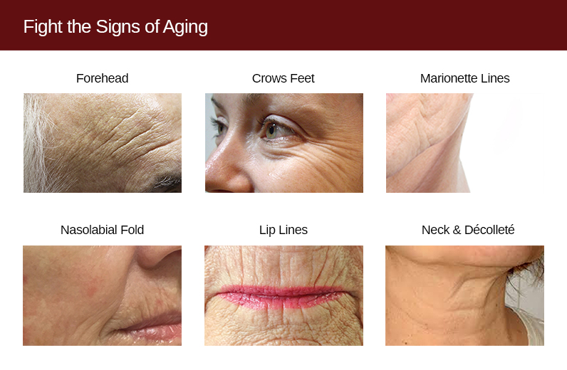 Fight the Signs of Aging