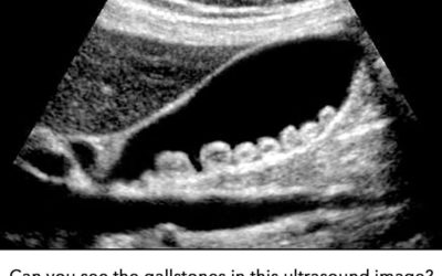 Why You Should Consider Totality For Your Ultrasound Imaging Needs