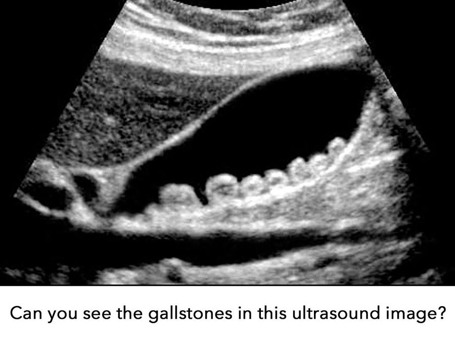 Why You Should Consider Totality For Your Ultrasound Imaging Needs