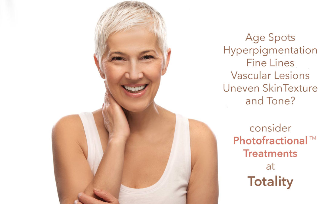 Consider the 2 step skin solution: Photofractional™ skin treatments