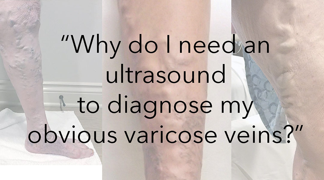 Why Do I Need an Ultrasound to Diagnose My Obvious Varicose Veins?