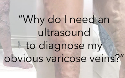 Why Do I Need an Ultrasound to Diagnose My Obvious Varicose Veins?