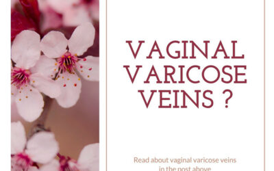 Veins 101: Vaginal Varicose Veins
