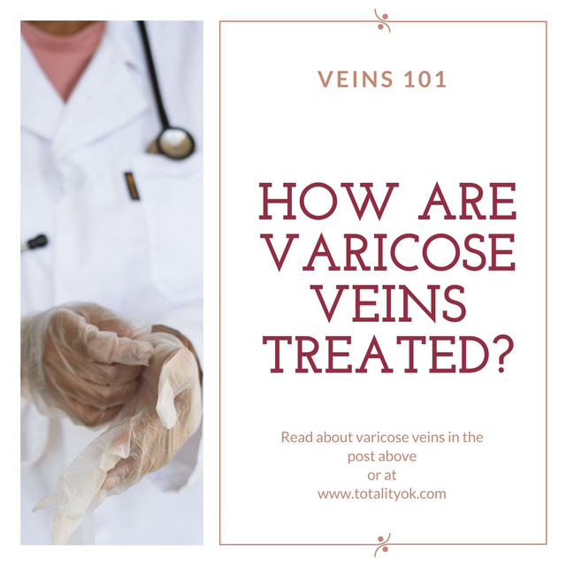Veins 101: How are Varicose Veins Treated?